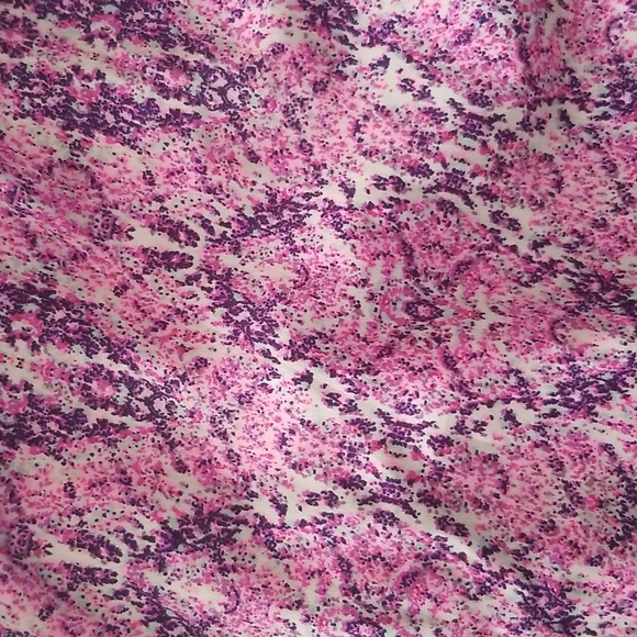 O'Neill Halter Dress, XS - Picture 7 of 7